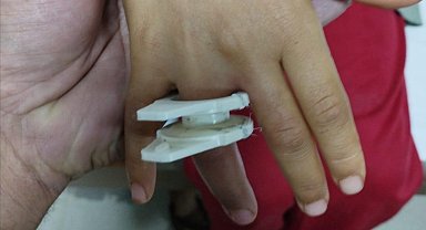 Parmağına plastik parçası sıkışan çocuğu itfaiye kurtardı