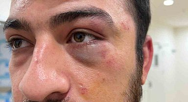 Şişli'de hemşir ile hasta arasında "eldiveni değiştir" kavgası: 3 gözaltı