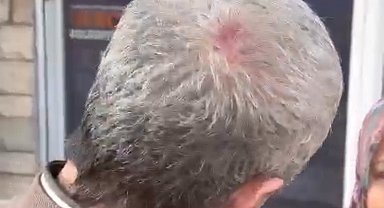 Maltepe'de broşür dağıtan AK Partili'yi darp etmişlerdi, 6 kişi gözaltına alındı